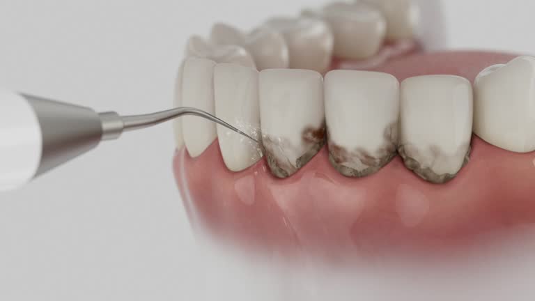 Reliable Dental Implants contractor in Ashland, CA by Smile Center Dentistry